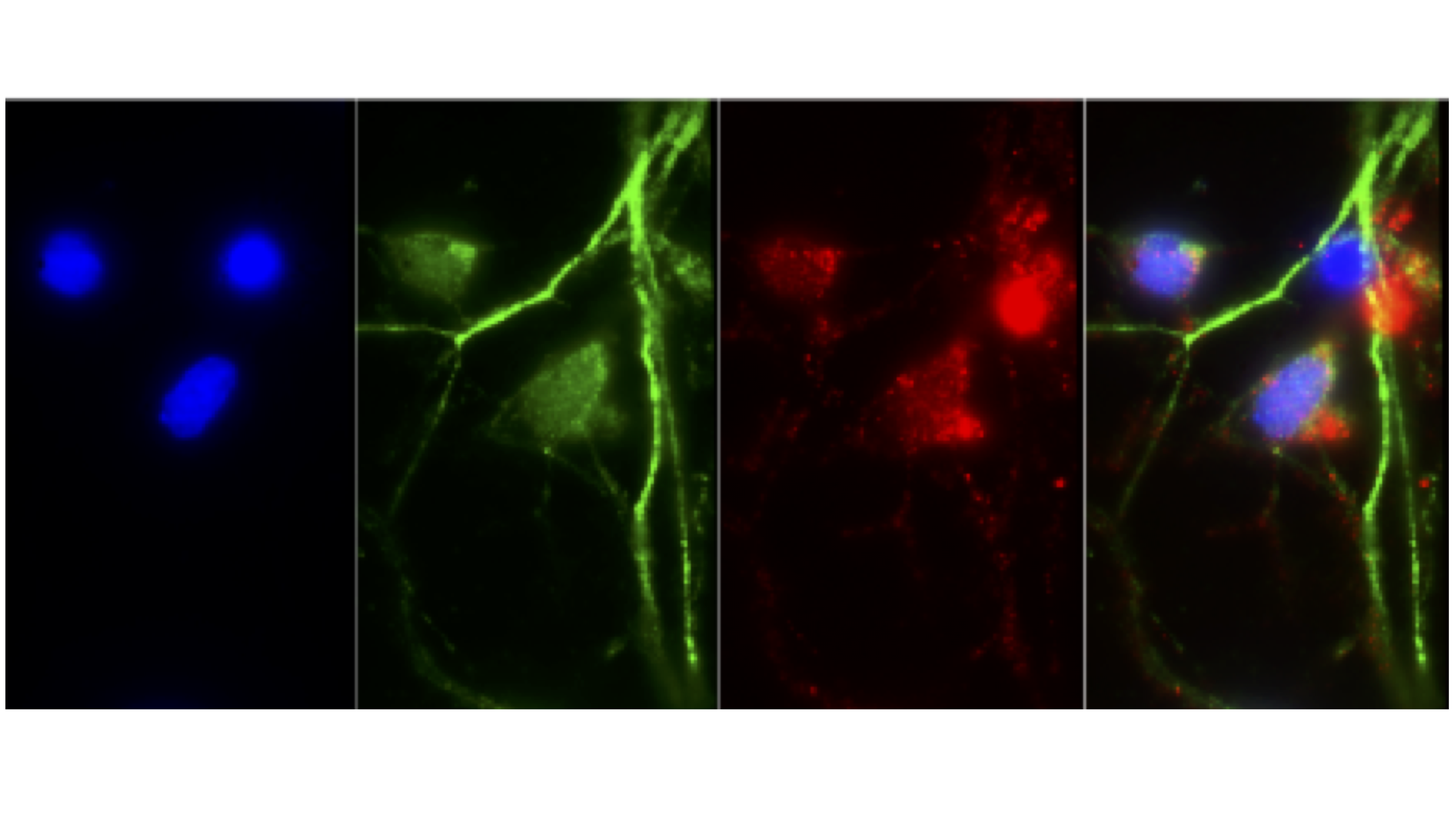 neurons from AD